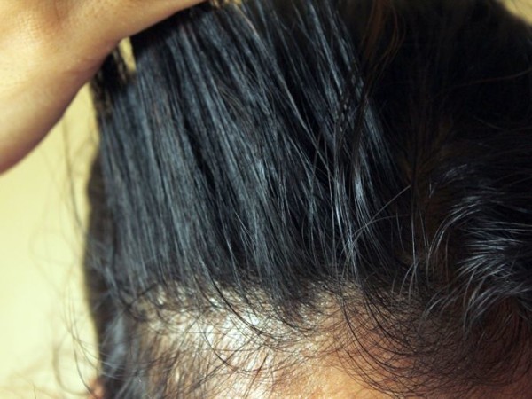 Why is my hair so oily